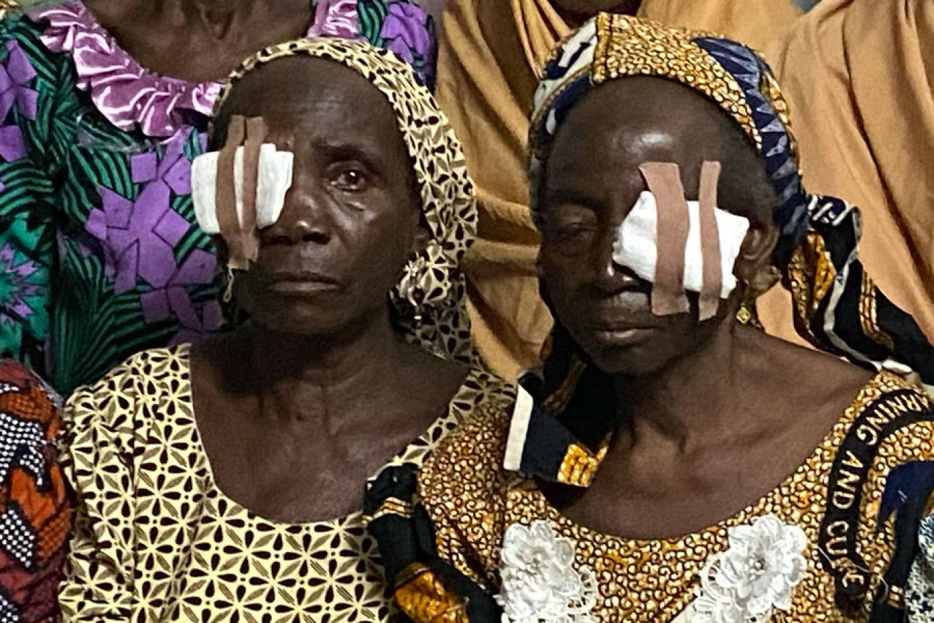 Cataract Surgeries 